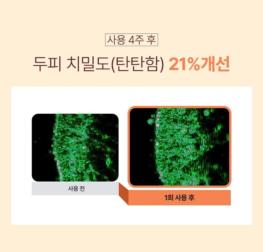 [New/현대약품특허]마이녹셀 뉴트리션 스칼프 볼륨 샴푸 480ml 상세페이지 19